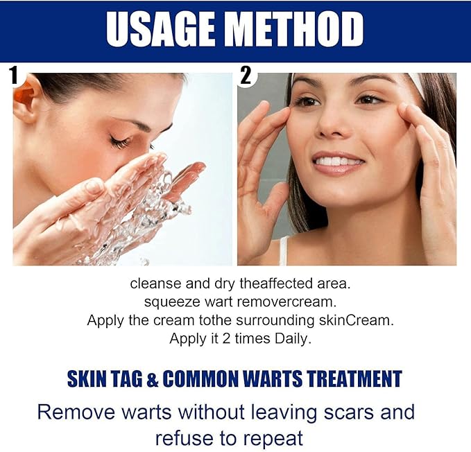 Wart Remover Instant Blemish Removal Cream šāØ
